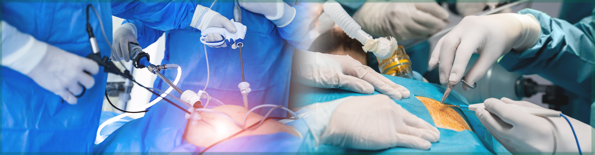 General and Laparoscopic Surgery